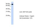 Periostin Antibody in Western Blot (WB)