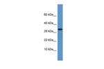 Apolipoprotein F Antibody in Western Blot (WB)