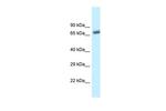 BTRC Antibody in Western Blot (WB)