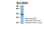 SLC30A3 Antibody in Western Blot (WB)