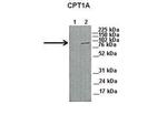 CPT1A Antibody in Western Blot (WB)