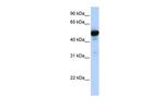 GluD1 Antibody in Western Blot (WB)