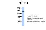 GluD1 Antibody in Western Blot (WB)