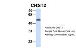 CHST2 Antibody in Western Blot (WB)