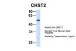 CHST2 Antibody in Western Blot (WB)