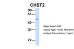 CHST2 Antibody in Western Blot (WB)