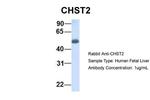 CHST2 Antibody in Western Blot (WB)