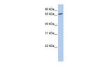 ATP6V0A1 Antibody in Western Blot (WB)