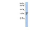 HS3ST6 Antibody in Western Blot (WB)