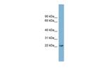 PERP Antibody in Western Blot (WB)