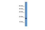 FXN Antibody in Western Blot (WB)