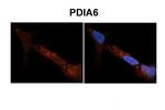 PDIA6 Antibody in Immunohistochemistry (IHC)