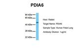 PDIA6 Antibody in Western Blot (WB)