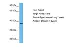 KERA Antibody in Western Blot (WB)