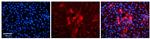 METL5 Antibody in Immunocytochemistry (ICC/IF)