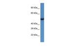 SESN1 Antibody in Western Blot (WB)