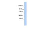 GNGT2 Antibody in Western Blot (WB)