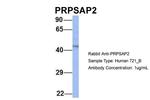 PRPSAP2 Antibody in Western Blot (WB)