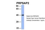 PRPSAP2 Antibody in Western Blot (WB)