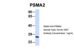 PSMA2 Antibody in Western Blot (WB)