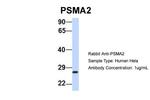 PSMA2 Antibody in Western Blot (WB)