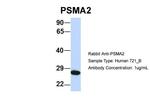 PSMA2 Antibody in Western Blot (WB)