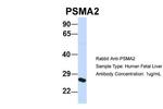 PSMA2 Antibody in Western Blot (WB)