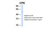 Carboxypeptidase E Antibody in Western Blot (WB)