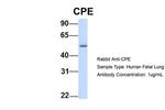 Carboxypeptidase E Antibody in Western Blot (WB)