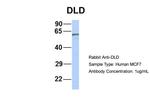 DLD Antibody in Western Blot (WB)