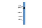 CPNE6 Antibody in Western Blot (WB)