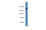 Cathepsin C Antibody in Western Blot (WB)