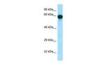 UTP15 Antibody in Western Blot (WB)