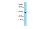 TOM1L1 Antibody in Western Blot (WB)