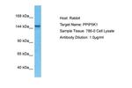 IP6 Kinase Antibody in Western Blot (WB)