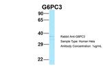 G6PC3 Antibody in Western Blot (WB)