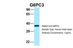 G6PC3 Antibody in Western Blot (WB)