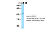 GNA11 Antibody in Western Blot (WB)