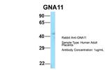 GNA11 Antibody in Western Blot (WB)