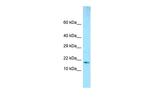 GMFB Antibody in Western Blot (WB)