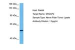 SRGAP2 Antibody in Western Blot (WB)