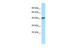 KIR2DL5B Antibody in Western Blot (WB)