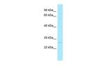 MBD3L1 Antibody in Western Blot (WB)