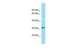 Gdpd1 Antibody in Western Blot (WB)