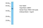 UBXN7 Antibody in Western Blot (WB)