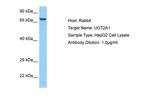 UD2A1 Antibody in Western Blot (WB)