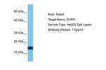 GHRH Antibody in Western Blot (WB)