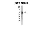 SERPINH1 Antibody in Western Blot (WB)