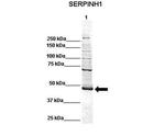 SERPINH1 Antibody in Western Blot (WB)