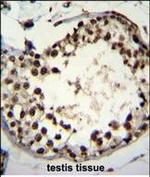 ASXL1 Antibody in Immunohistochemistry (Paraffin) (IHC (P))